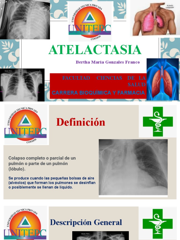 Atelactasia | PDF | Tos | Pulmón