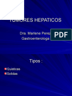 Tumores Hepaticos