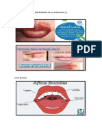 Enfermedades de La Cavidad Oral