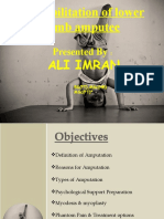 Rehabilitation of Lower Limb Amputee Ali Imran: Presented by