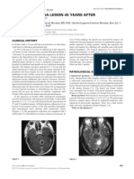 0610case1 Metastatic Melanoma