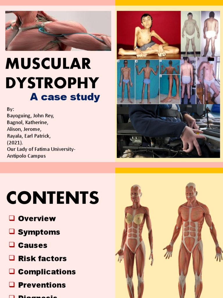 Overview of Muscular Dystrophy Cases | PDF | Muscular Dystrophy | Neurology
