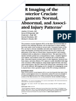 MR Imaging Reveals Patterns of Posterior Cruciate Ligament Injuries