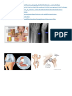 Investigacion Sobre Paralisis, Fractura, Rotura, Luxacion-Morfo