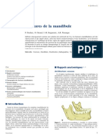 Fractures de La Mandibule