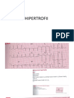 LP 2 - Exercitii hipertrofii