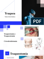 Cirugia de Traquea