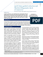 Surgical Stent and C-Arm Guided Reduction and