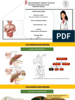 Col Angio Carcinoma