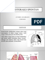 Pneumothorax Spontan