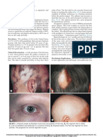 Alopecia Areata: Habif's Clinical Dermatology