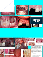Álbum de Patologías Del Paciente Desdentado Total