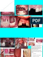 Signos dentales y síntomas de enfermedades