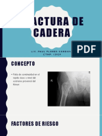 Fractura de Cadera