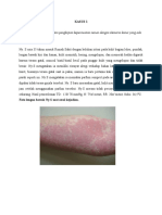 Dermatitis alergi akibat parfum