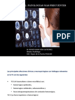 TAC CEREBRAL PATOLOGIAS MAS FRECUENTES Practica