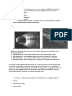 SACG Diagnosis