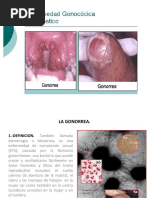 La Gonorrea