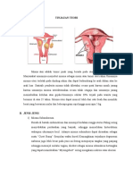 Tinjauan Teori Mioma Uteri