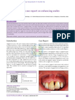 Gingival Mask: A Case Report On Enhancing Smiles: ASE Eport