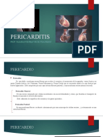 Pericarditis