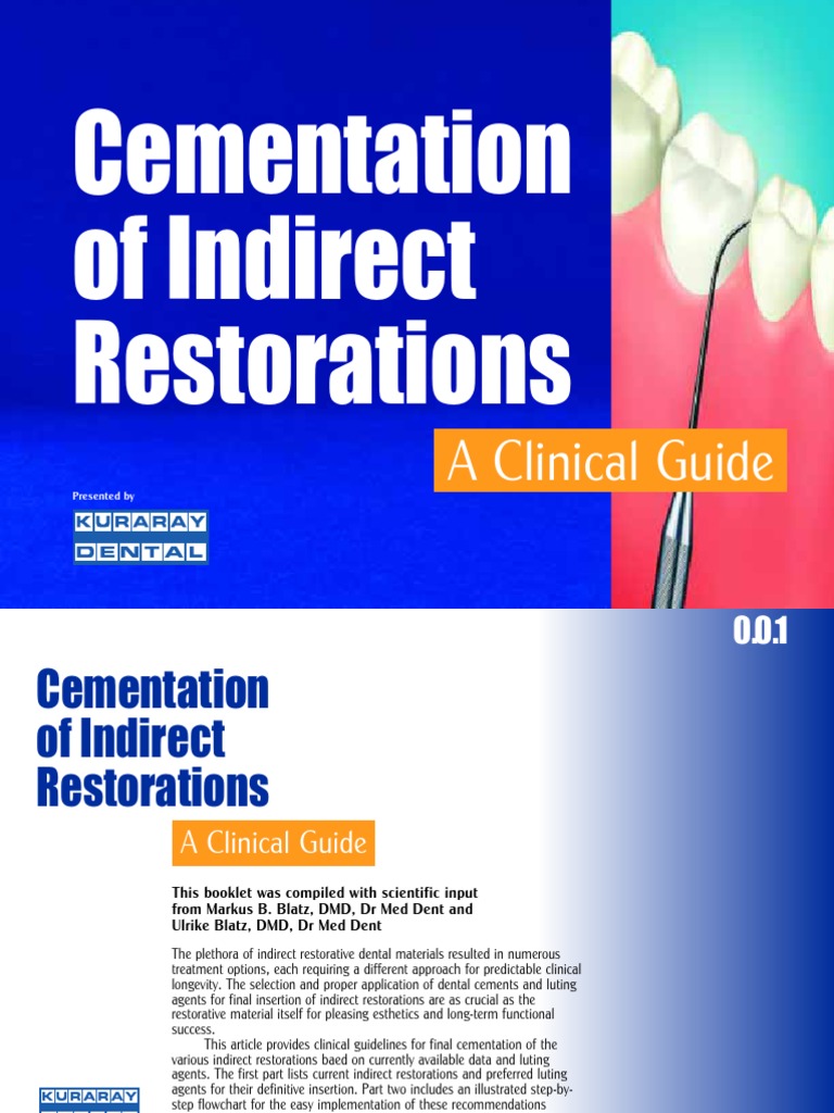 Kuraray Cementation Indirect Restorations Guide | PDF | Dental ...