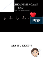 EKG Fivi