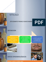 Vitiligo