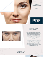 Blefaroplastia