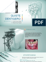 Quiste Dentigero