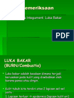 Luka Bakar