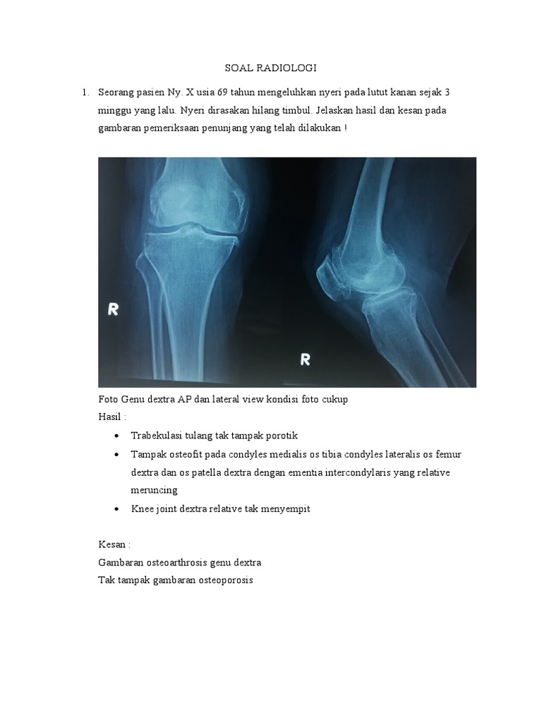 Hasil Rontgen Genu Dextra dan Thorax | PDF