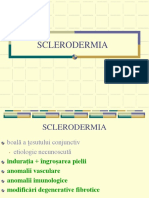 Sclerodermia