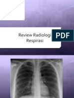 Review Radiologi Respirasi