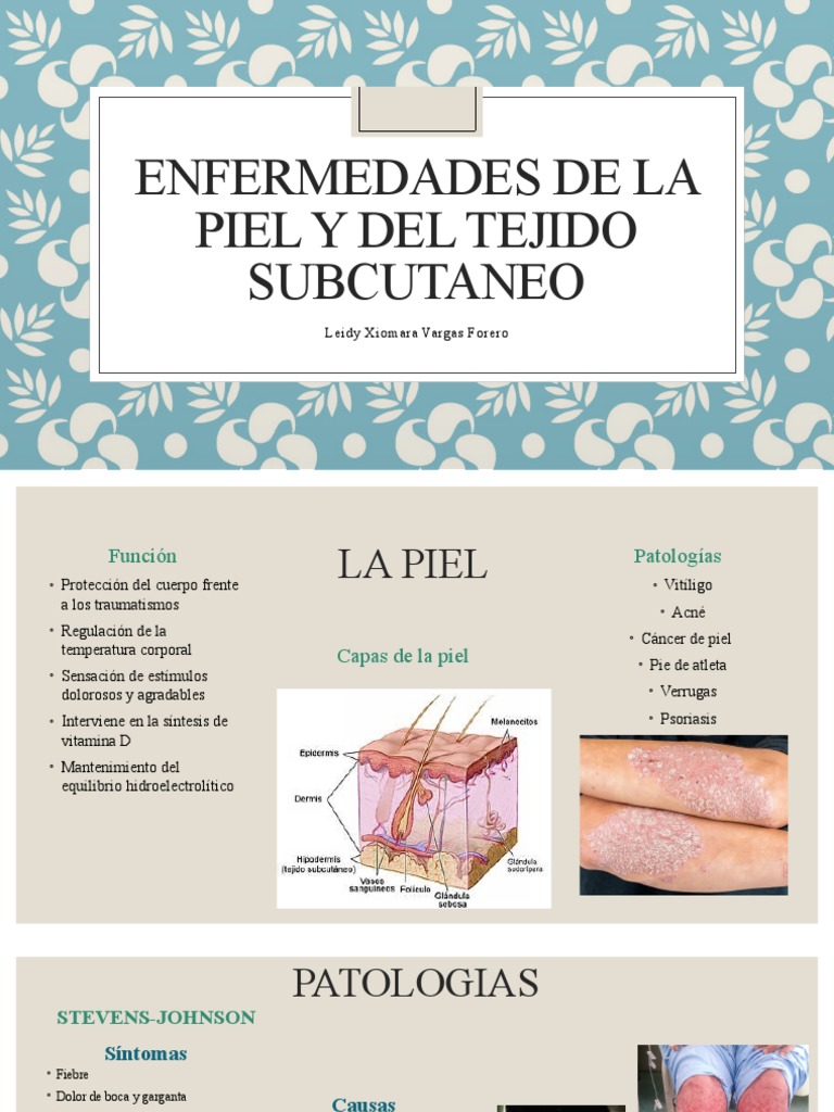 Infección Local De La Piel Y Del Tejido Subcutáneo, No Especificada – UZAO