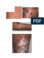 INFECTO6_CASO CLINICO LEISHMANIASIS