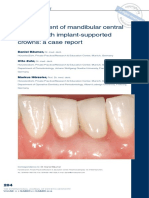 Replacement of Mandibular Central Incisors With Implant-Supported Crowns: A Case Report
