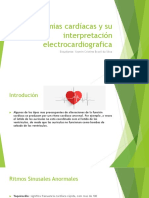 Arritmias Cardíacas y Su Interpretación Eletrocardiografica