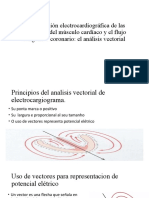 Análisis vectorial ECG