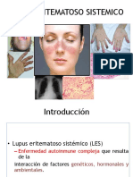 Lupus Eritematoso Sistémico 2021 Corregido