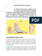 Diferencias de Pie Cavo A Pie Plano