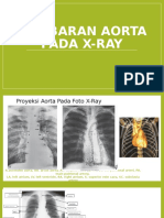 Gambaran Aorta Pada X Ray