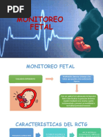 Guía de Interpretación de RCTG Fetal | PDF | Hipoxia (médica) | Parto