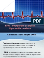 EKG Interpretare. Hipertofia