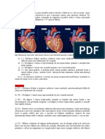 Arritmia Cardíaca 3