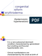 Bullous Congenital Ichthyosiform Erythroderma