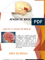 Afasia de Broca