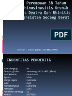 Rinosinusitis