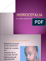 HIDROCEFALIA