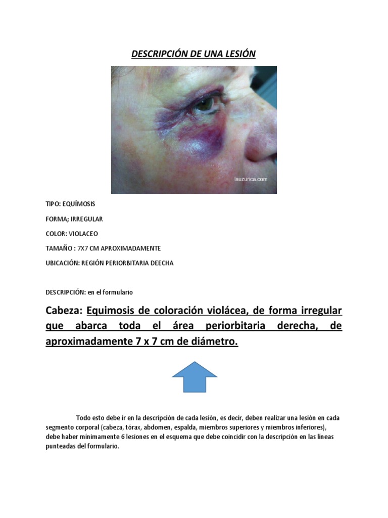 Descripción de Una Lesión | PDF
